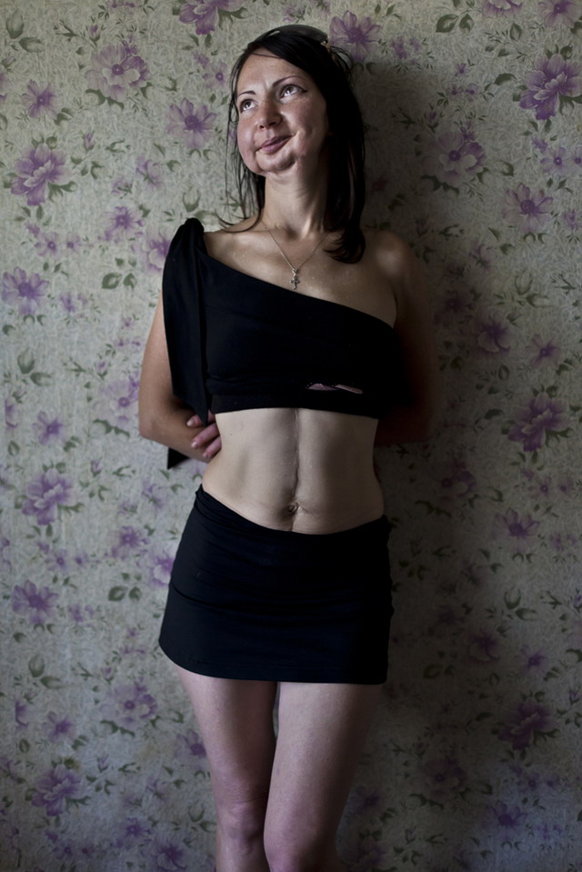 Харьков. Оксана, 33 года. ВИЧ-позитивная. Принимает наркотики, хочет бросить.