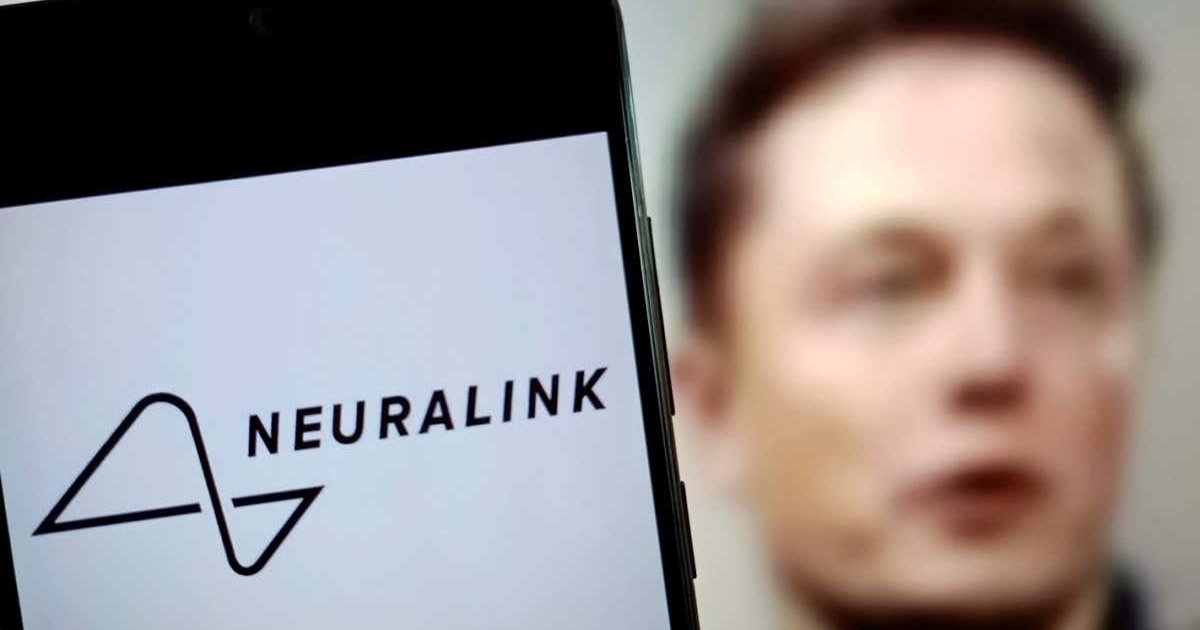 Стартап Ілона Маска Neuralink успішно імплантував мозковий чип другому пацієнту