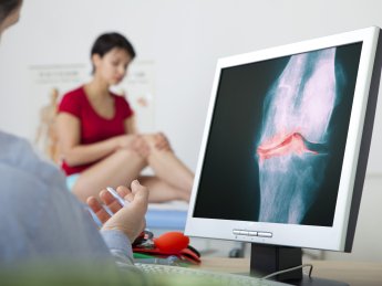 ШІ навчили визначати остеоартрит на 8 років швидше за рентген