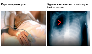 Фото 3 — Кабмін скасував старі картинки про шкоду сигарет на пачках: в січні їх замінять новими, більш жахаючими (ФОТО)