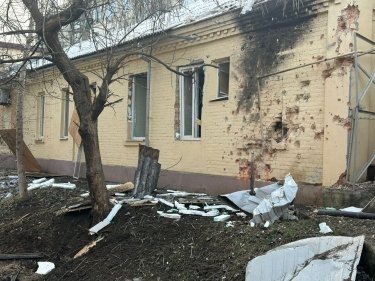 Фото 4 — Обстрелы Днепропетровской и Сумской областей: как прошел день в регионах (ФОТО)