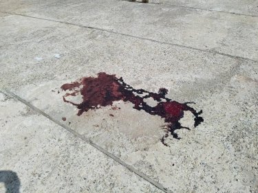 Фото 3 — 22 человека ранены и один погиб в результате обстрела южной части Николаева