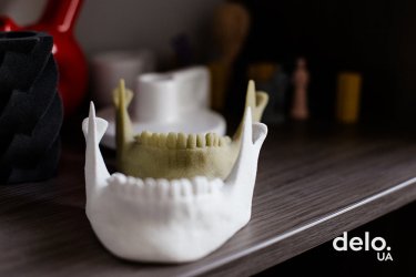 Фото 10 — Kwambio: украинцы учатся печатать на 3D-принтере кости человека