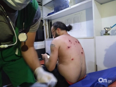 Фото 3 — В Тбилиси продолжаются столкновения протестующих с полицией: "Идет реальная война" (ВИДЕО)