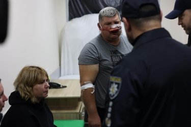 Фото 10 — Число погибших при обстреле гражданской колонны в Запорожской области выросло до 30, раненых - до 88