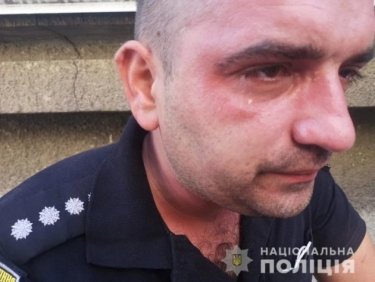 Фото 2 — Столкновения Нацкорпуса с полицией на Банковой: пострадали 8 правоохранителей (ФОТО)