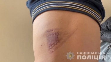 Фото 5 — Николаевскую бизнес-леди задержали, подозревая в пытках двух греков ради квартир (ВИДЕО)