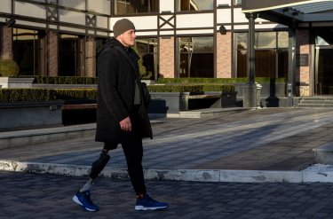 Фото 4 — В Естонії першим двом українцям безкоштовно зробили біонічні протези ніг (ФОТО)