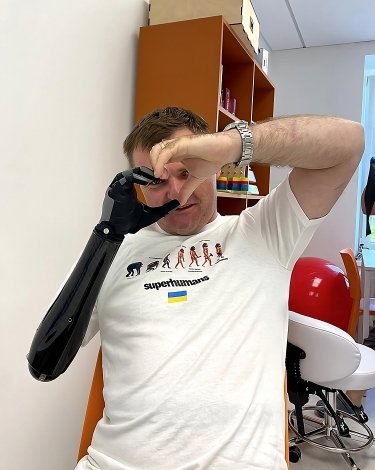 Фото 2 — АЛЛО передала 15 млн гривень на виготовлення високотехнологічних протезів для українських героїв