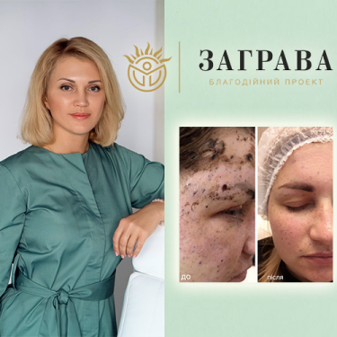 Фото 3 — Повертаємо красу у воєнні часи: корекція шрамів, травматичних уражень шкіри