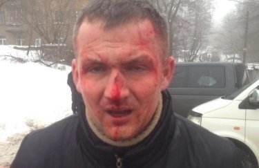 Нардепа-свободовца избили на месте скандальной стройки в Киеве (фото)