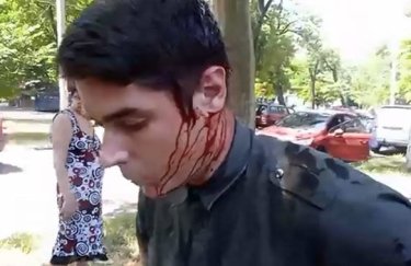 В Одессе ранили активиста "Автомайдана" Устименко