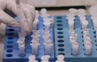 В Украине лабораторно подтвердили новые случаи коронавируса. Фото: 34.ua