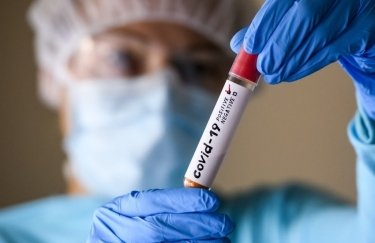 В Украине резко вырос суточный уровень заболеваемости коронавирусом: более 18 тысяч новых случаев Covid-19