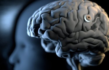 Компания Маска по производству мозговых имплантатов ищет партнера для испытаний на людях