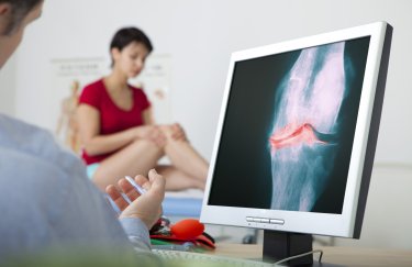 ШІ навчили визначати остеоартрит на 8 років швидше за рентген