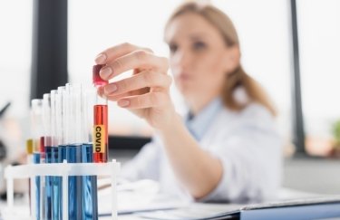 Житомирський центр крові закупив неякісні тести на антитіла до SARS-CoV-2 на 3,8 млн грн