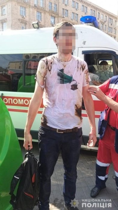 Фото 2 — Мужчина поджег себя во время парада ко Дню Независимости в Киеве (ФОТО, ВИДЕО)