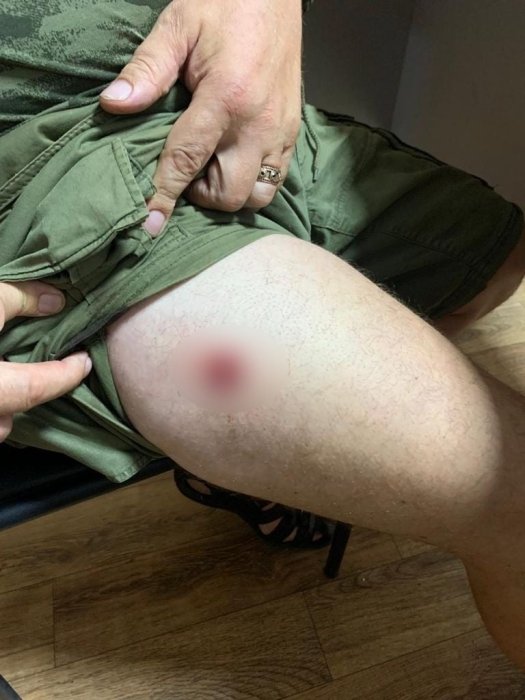 Фото 3 — В Киевской области мужчины устроили стрельбу из-за нехватки мест в цирке (ФОТО)